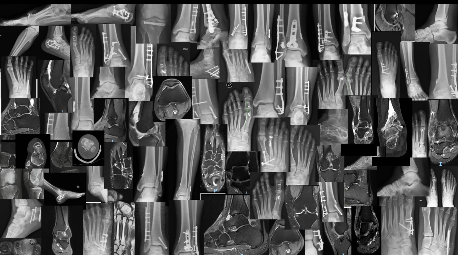 Collage de radiografías, resonancias y tomografías de rodilla, pie y tobillo